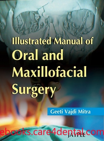 pdf oral maxillofacial surgery manual illustrated dental books ebooks care4dental