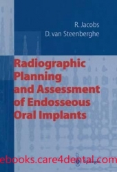 Radiographic Planning and Assessment of Endosseous Oral Implants (pdf)