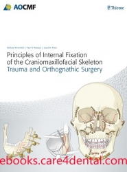 Principles of Internal Fixation (pdf)