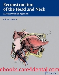 Reconstruction of the Head and Neck: A Defect-Oriented Approach (pdf)