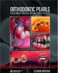 Orthodontic Pearls: A Selection of Practical Tips and Clinical Expertise (pdf)
