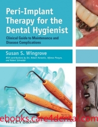 Peri-Implant Therapy for the Dental Hygienist: Clinical Guide to Maintenance and Disease Complications (pdf)