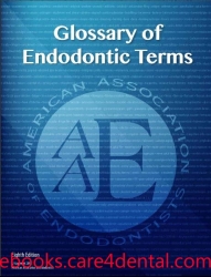 Glossary of Endodontic Terms