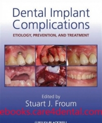 Dental Implant Complications Etiology, Prevention and Treatment (pdf)