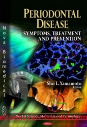 Periodontal Disease: Symptoms, Treatment and Prevention (pdf)
