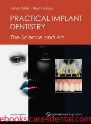 Practical Implant Dentistry: The Science and Art, 2E (pdf)